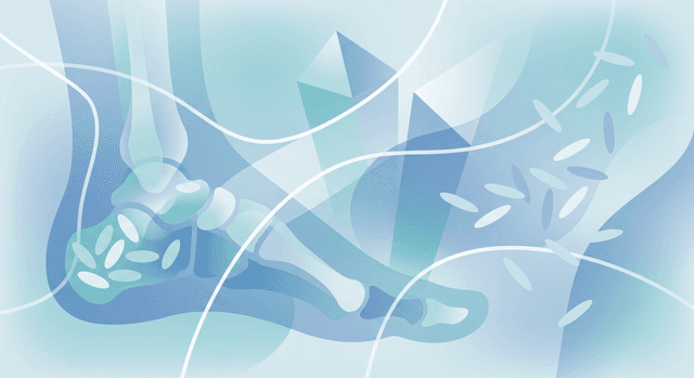 Based on CDC | Does eating white rice increase the risk of gout attacks by raising uric acid levels?