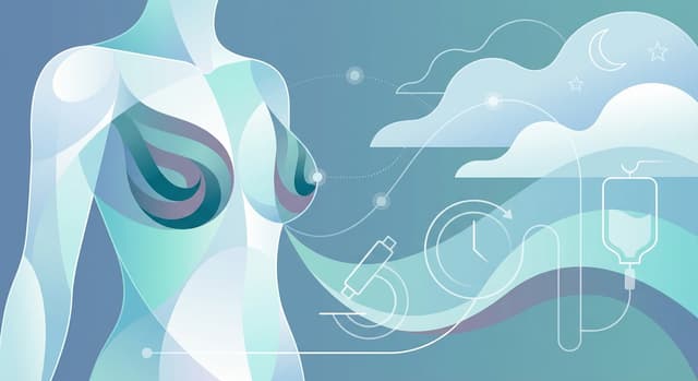 Sleep needs in breast cancer: how much and why